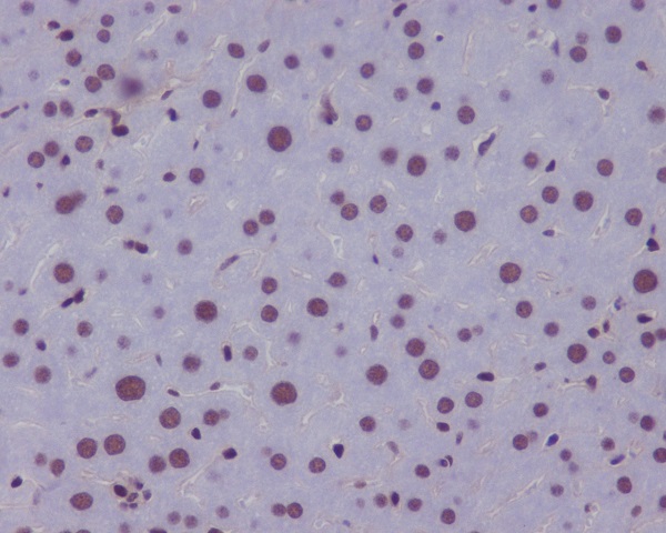IHC - Anti-KLF4/Gklf Rabbit Monoclonal Antibody ABO13501